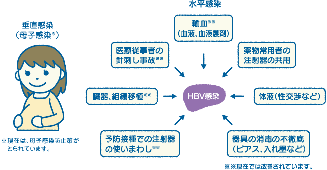 垂直感染(母子感染)と水平感染